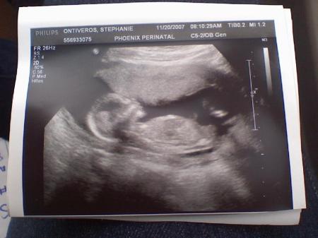 My second granddaughter. Due May 10, 2008