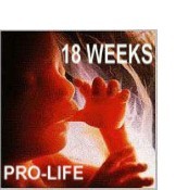 18 Week old Unborn Baby