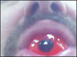 eyeball