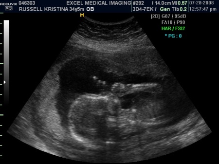 Baby Bean Jr. 7-28-08