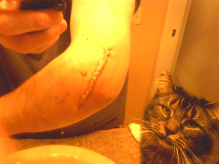 Elbow Surgery & my cat