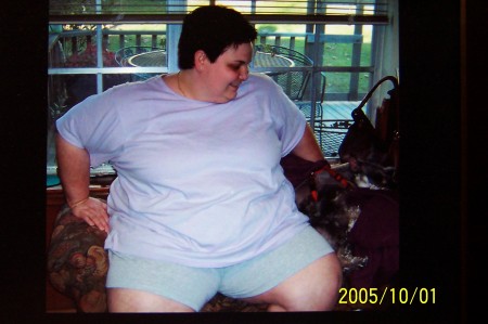 me before my lap band surgery in 2005