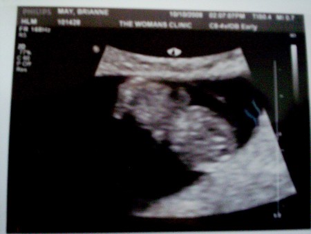 9 wk ultrasound. Due May 15, 09!