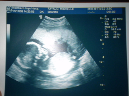 1st Grand Baby...Due March 2009