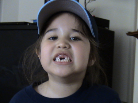 All I want for softball are my 2 front teeth.