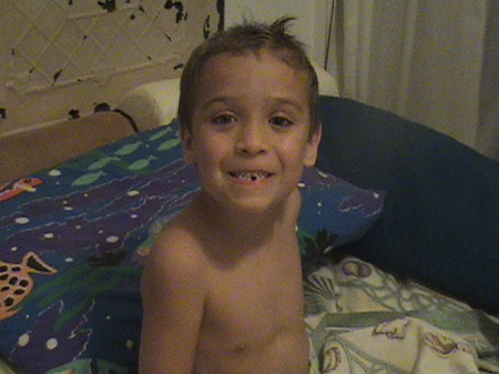 Seanan and his missing tooth