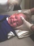 Jr. getting 1st stitches