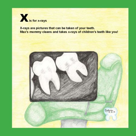 X is for Xray