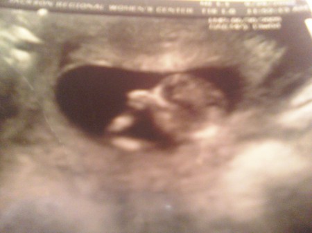 the "one" on the way :)