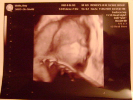 My 4th baby, a girl!! (Due 2-11-10)
