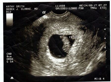 baby mayes first picture