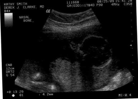 baby may's second picture