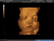 3-D Pix of my baby at 34 weeks