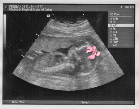 It's a girl. Elena Fernandez due Dec 1, 2009