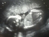 my granddaughter in Misti's womb...YAY!!!