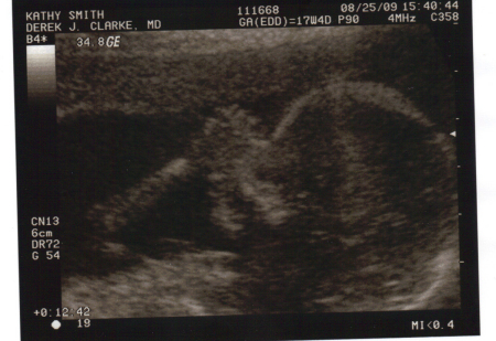 baby may at 18 weeks