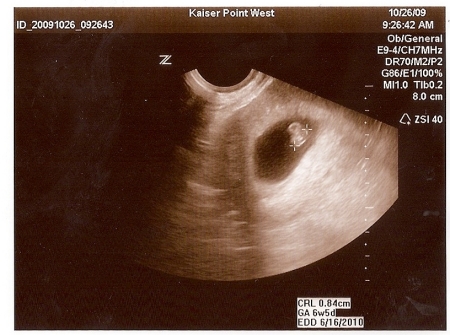 Baby due June 2010