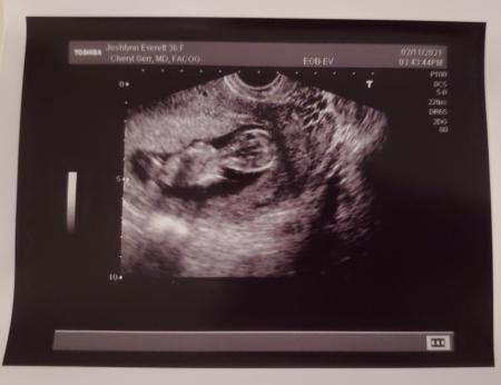 My Daughter's Great News! 