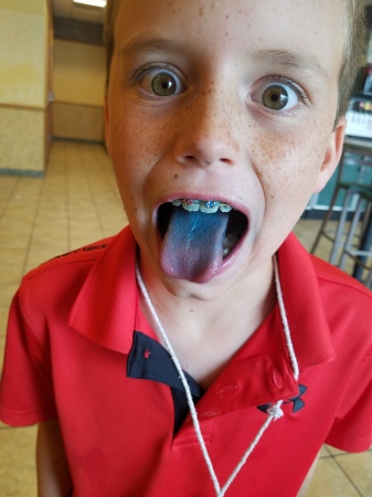 Deadly Blue tongue disease