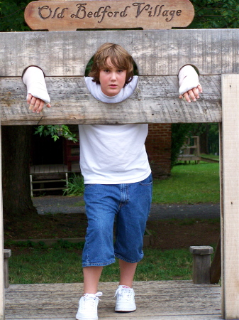 Duncan with two broken arms in the stocks!